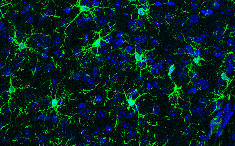 Vue au microscope - tapis de microglies (en vert) avec noyaux cellulaires (en bleu) © Sonia Garel 