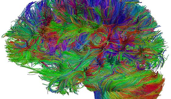 Cerveau humain reconstitué en tractographie © Laurent PETIT  IMN - GIN  CNRS Photothèque